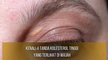 Kolesterol Tinggi