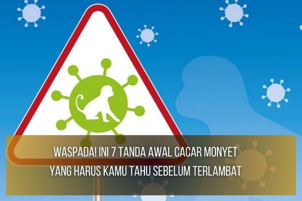 Tanda Awal Cacar Monyet Tanda Awal Cacar Monyet